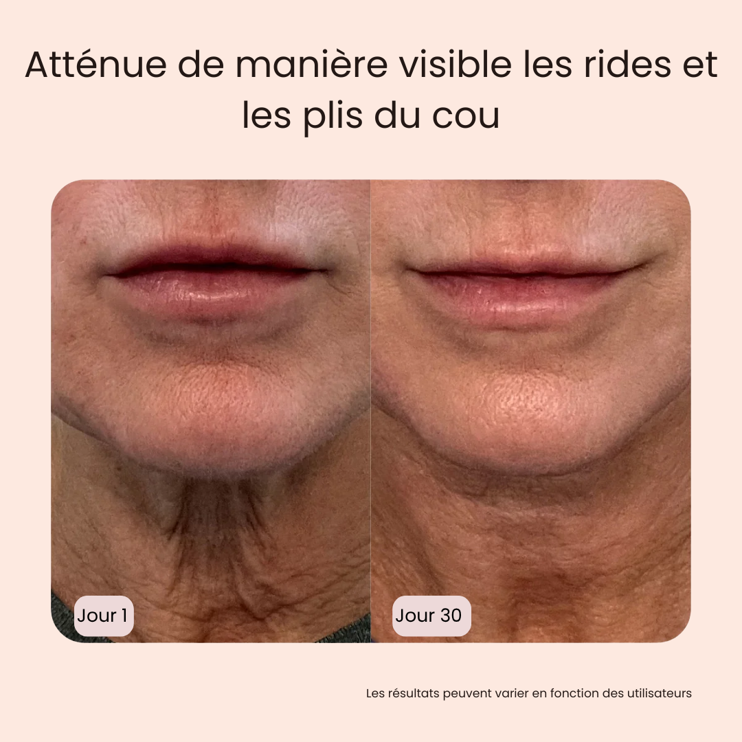 SkeenStick® - Votre rituel contre les cernes