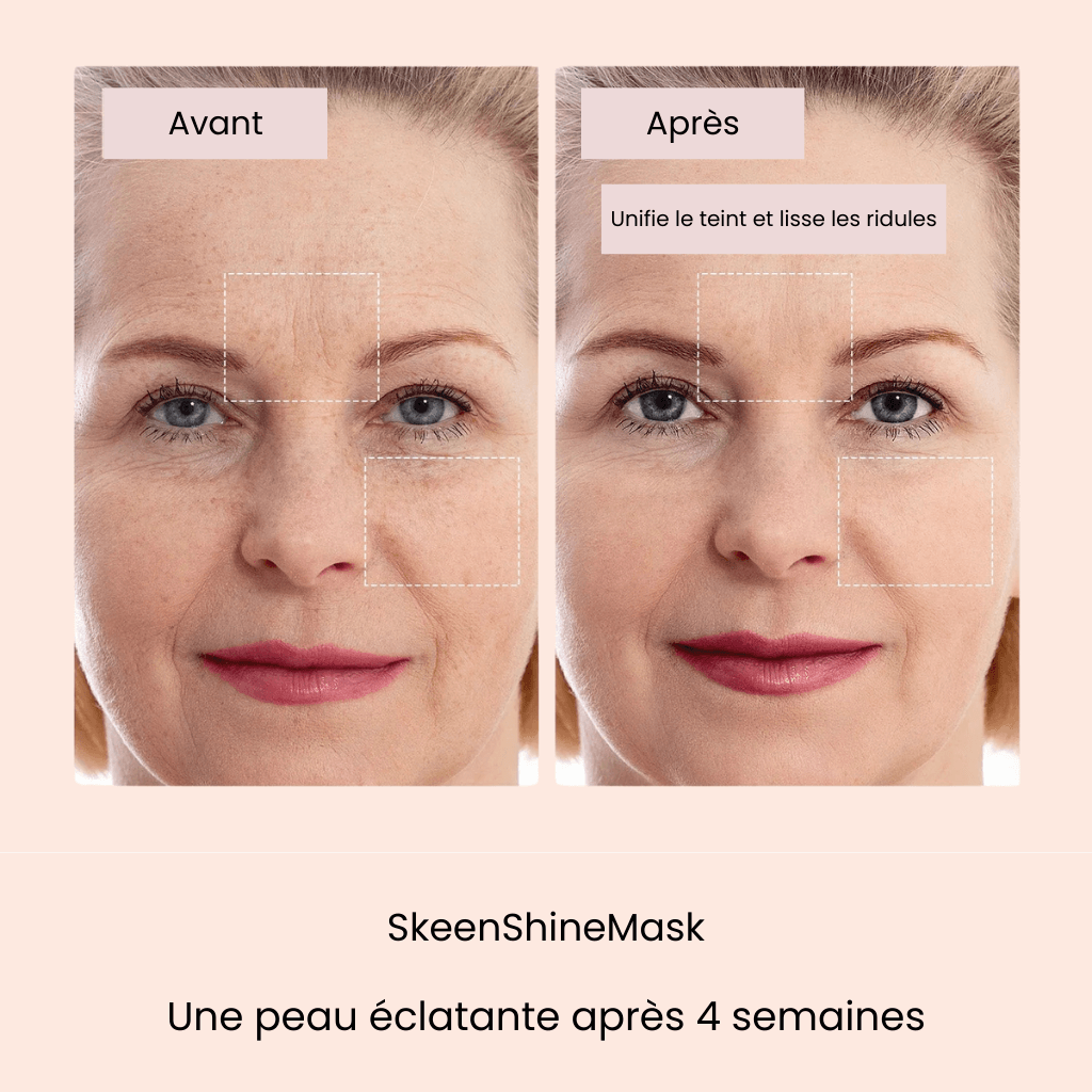 SkeenShineMask® - Eliminez rides et traces d'acné en 4 semaines