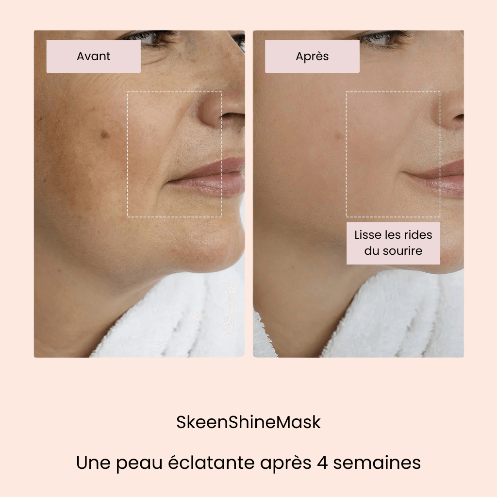 SkeenShineMask® - Eliminez rides et traces d'acné en 4 semaines