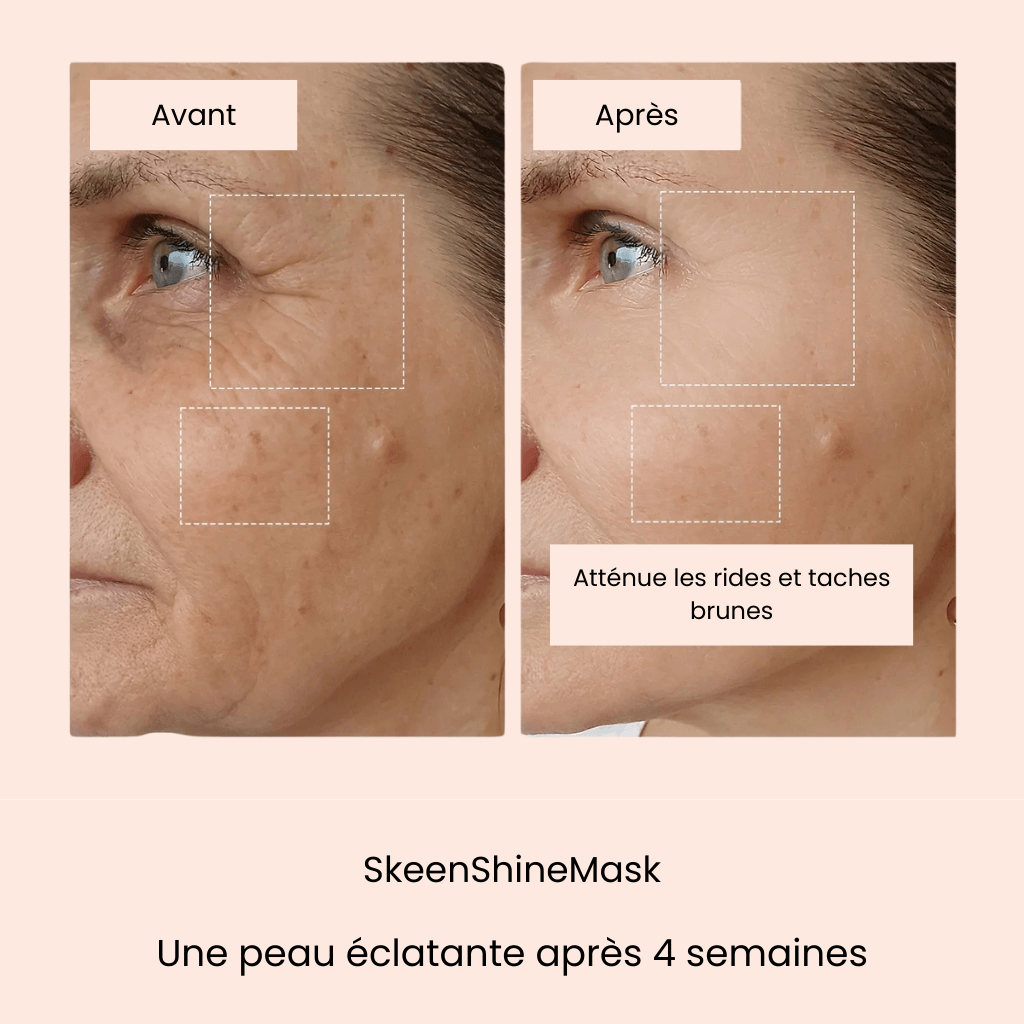 SkeenShineMask® - Eliminez rides et traces d'acné en 4 semaines