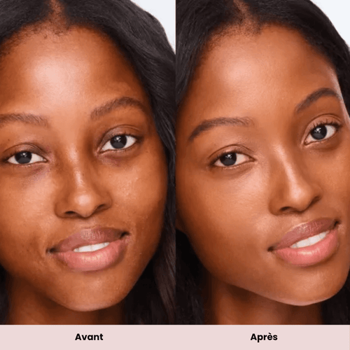 Lilou 25 ans – avis client masque LED peau ferme imperfections estompées