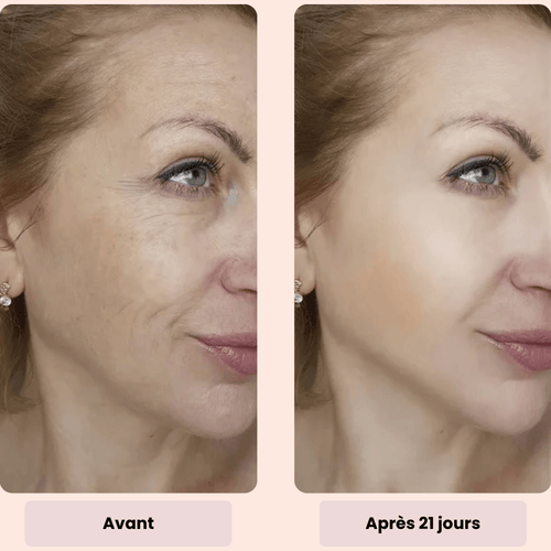 Marlène 48 ans – résultat masque LED 3 semaines peau ferme rides atténuées